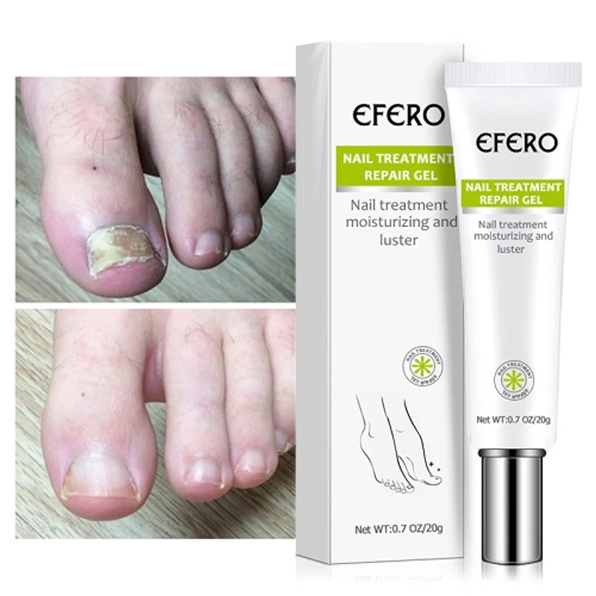 Fungal Removal Nail Treatment