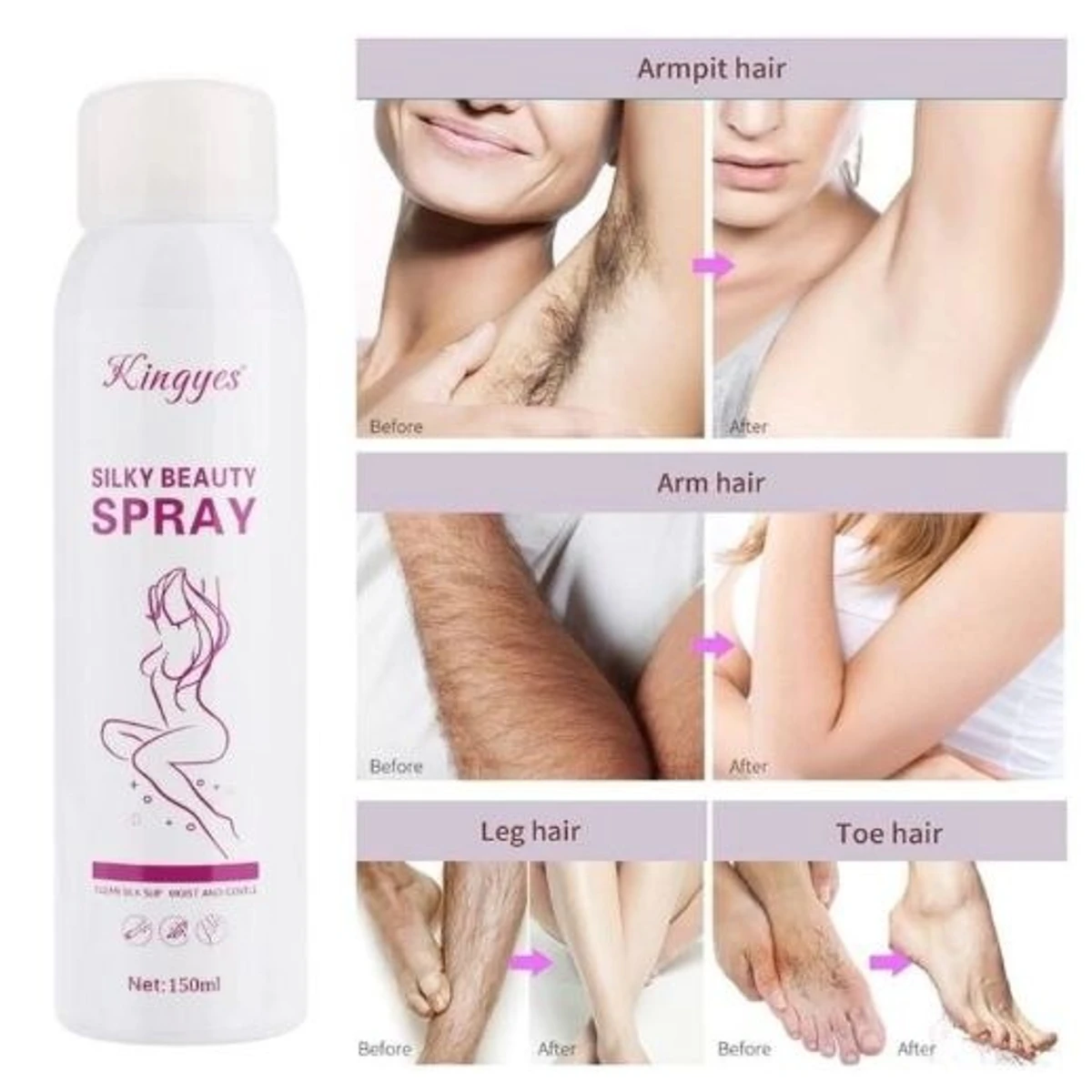 Kingyes Smooth Body Hair Removal Spray for Men and Women.